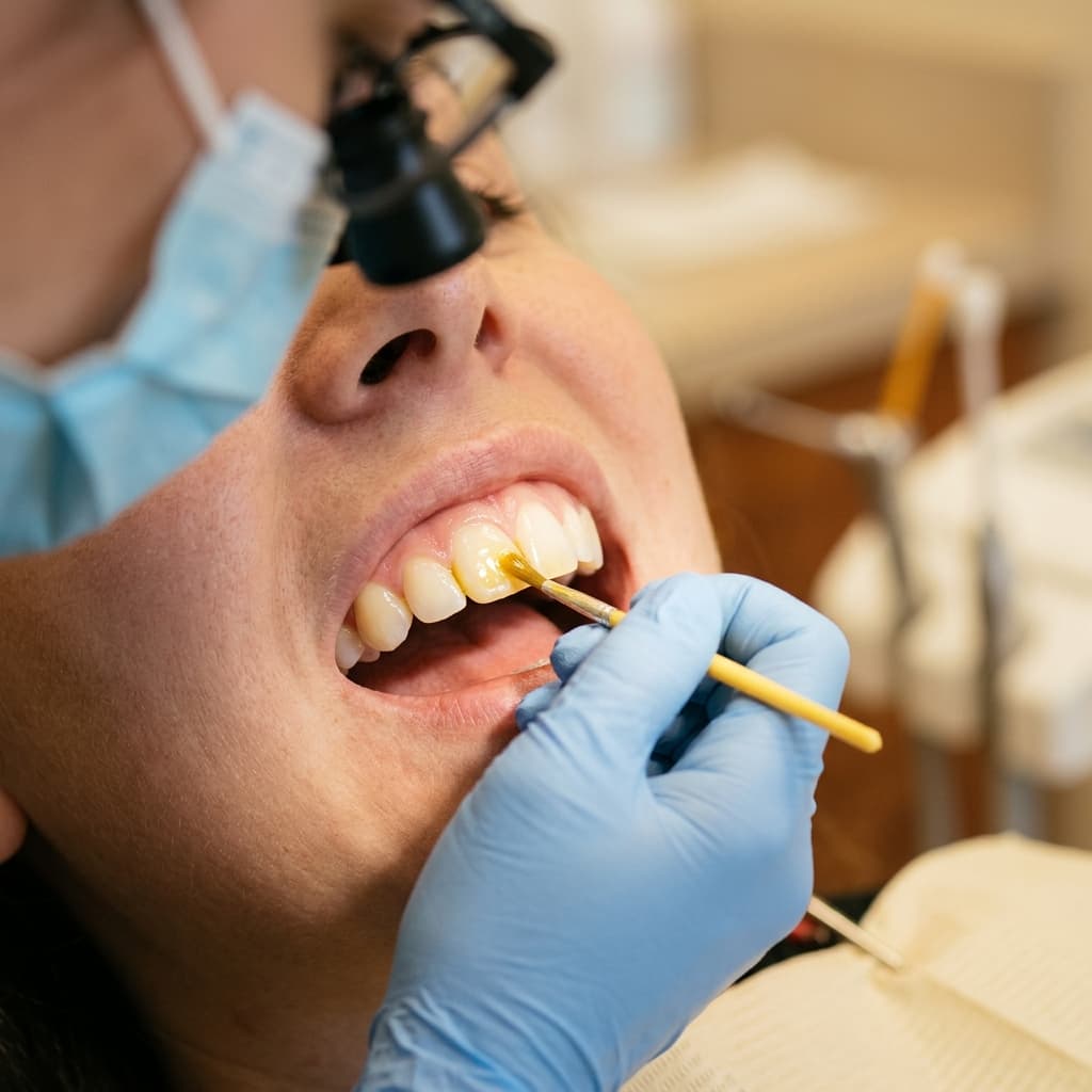 Fluoride Protection